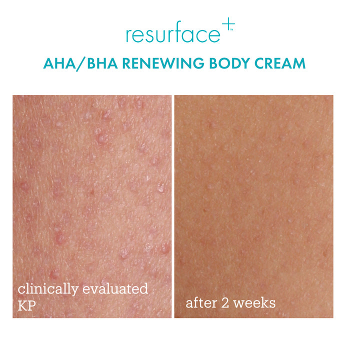 Resurface+ AHA/BHA Renewing Cream Before+After