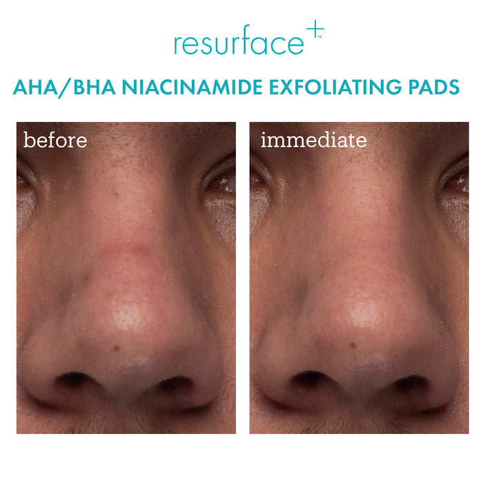 Resurface+ AHA/BHA Niacinamide Exfoliating Pads Before+After face